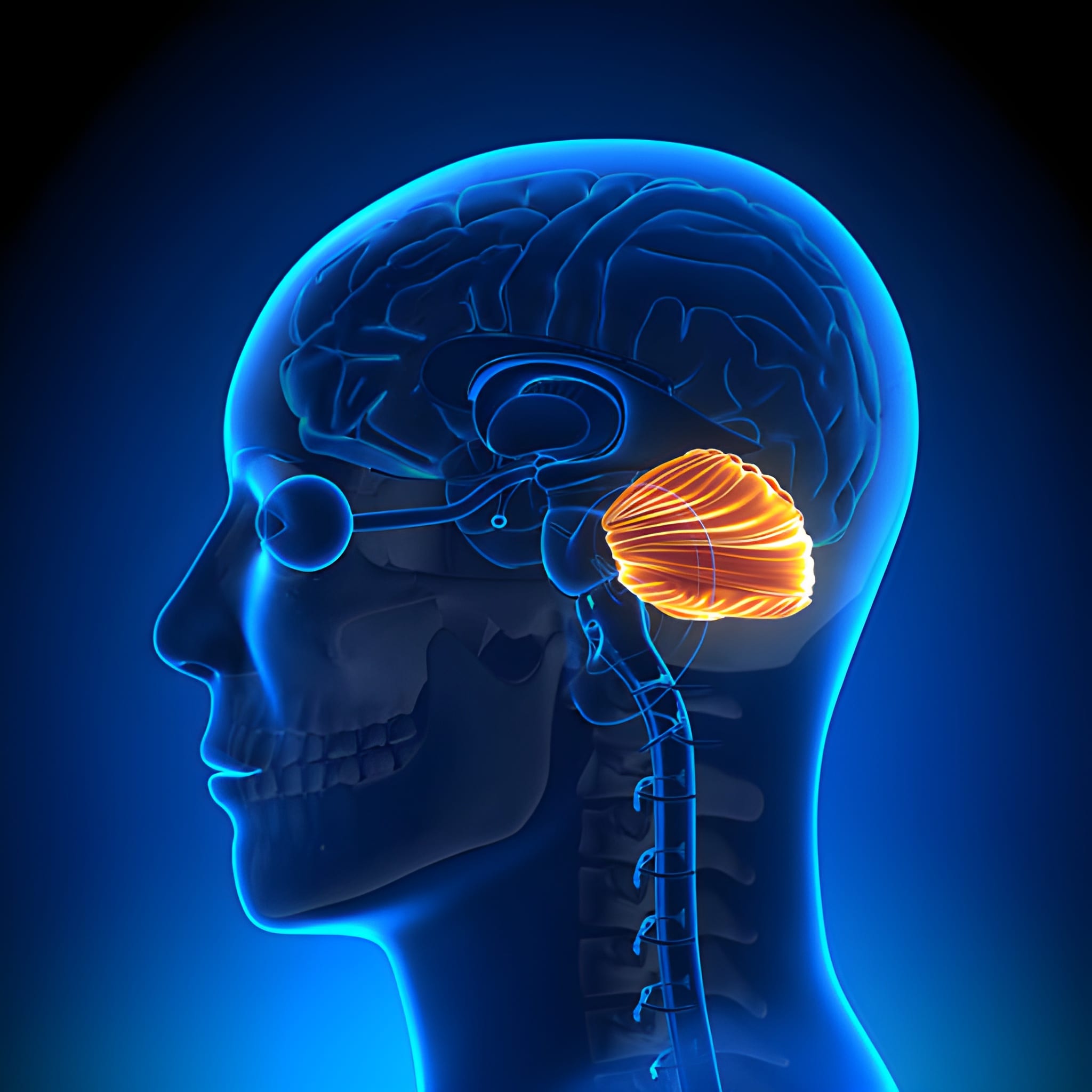 Beyincik Sarkması (Arnold Chiari)